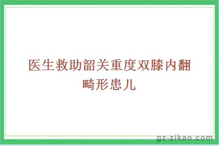 医生救助韶关重度双膝内翻畸形患儿